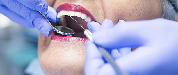 Best Emergency Root Canal Treatment in Port Richey, FL